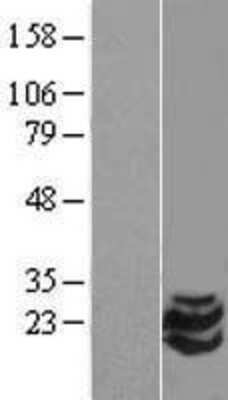 Western Blot: Stathmin-2/STMN2 Overexpression Lysate [NBL1-16558]