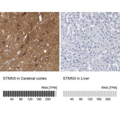 Immunohistochemistry-Paraffin: STMN3 Antibody [NBP1-80779]