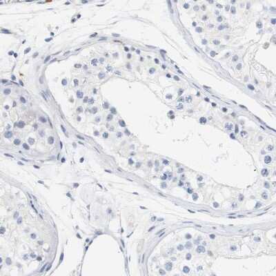 Immunohistochemistry-Paraffin: STMN3 Antibody [NBP1-80779]