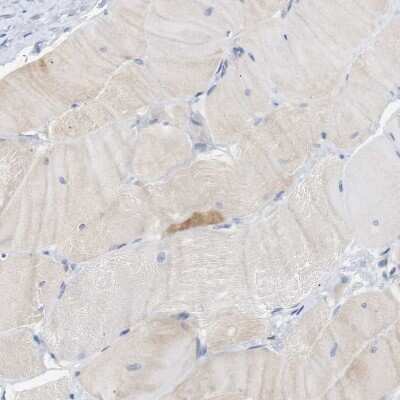 Immunohistochemistry-Paraffin: STMN3 Antibody [NBP1-80779]
