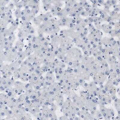 Immunohistochemistry-Paraffin: STMN3 Antibody [NBP1-80779]