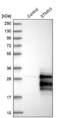 Western Blot: STMN3 Antibody [NBP1-80779]