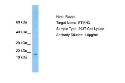 Western Blot: STMN3 Antibody [NBP2-85838]