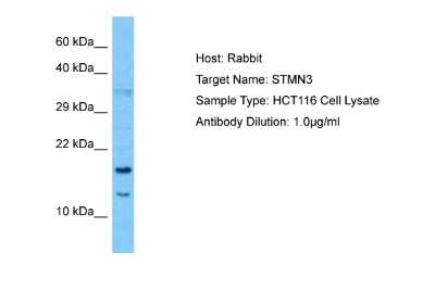 Western Blot: STMN3 Antibody [NBP2-85840]