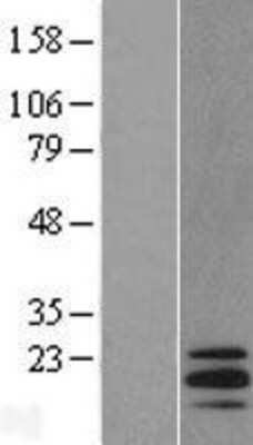 Western Blot: STMN3 Overexpression Lysate [NBL1-16559]