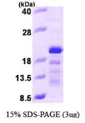 SDS-PAGE: Recombinant Human STMN3 His Protein [NBP1-44469]