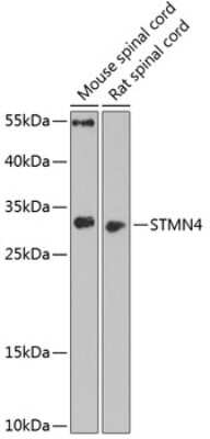 Western Blot: STMN4 AntibodyBSA Free [NBP2-94897]