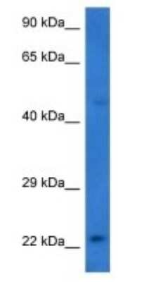 Western Blot: STMN4 Antibody [NBP3-09444]