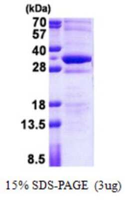 SDS-PAGE: Recombinant Human STMN4 His Protein [NBP2-22830]