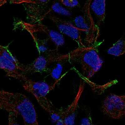 Immunocytochemistry/ Immunofluorescence: STMND1 Antibody [NBP2-57594]