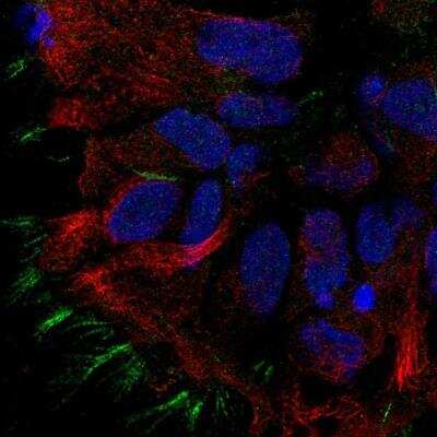 Immunocytochemistry/ Immunofluorescence: STOML3 Antibody [NBP1-84832]