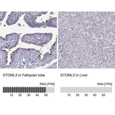 Immunohistochemistry-Paraffin: STOML3 Antibody [NBP2-62610]
