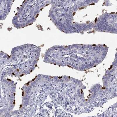 Immunohistochemistry-Paraffin: STOML3 Antibody [NBP2-62610]