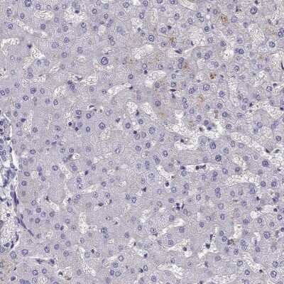 Immunohistochemistry-Paraffin: STOML3 Antibody [NBP2-62610]