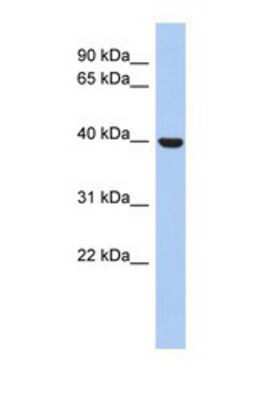 Western Blot: STOML3 Antibody [NBP1-69232]