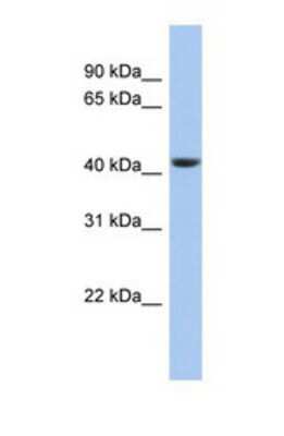 Western Blot: STOML3 Antibody [NBP1-69233]