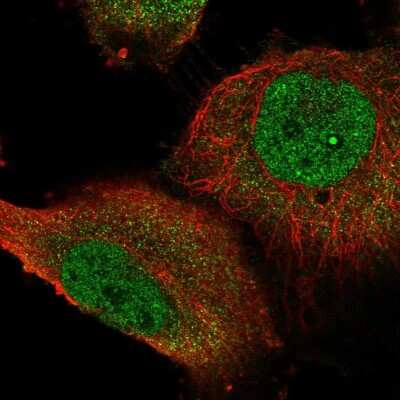 Immunocytochemistry/ Immunofluorescence: STOX1 Antibody [NBP2-55177]