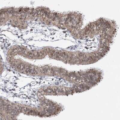 Immunohistochemistry-Paraffin: STOX1 Antibody [NBP1-90745]