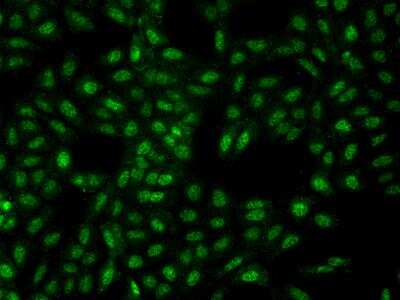 Immunocytochemistry/ Immunofluorescence: STPG4 Antibody [NBP3-06297]