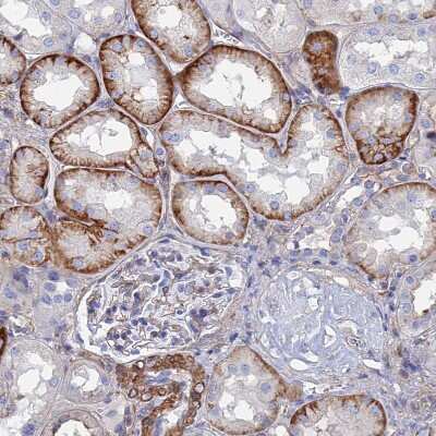 Immunohistochemistry-Paraffin: STRA6 Antibody [NBP1-83719]