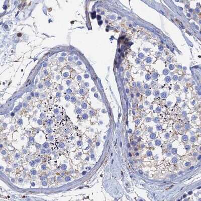 Immunohistochemistry-Paraffin: STRA6 Antibody [NBP1-83719]