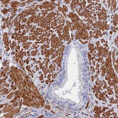 Immunohistochemistry-Paraffin: STRA6 Antibody [NBP1-83719]