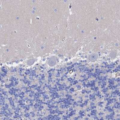 Immunohistochemistry-Paraffin: STRA6 Antibody [NBP1-83719]