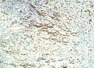 Immunohistochemistry-Paraffin: STRA6 Antibody [NBP3-12353]