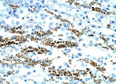 Immunohistochemistry-Paraffin: STRA6 Antibody [NBP3-12353]