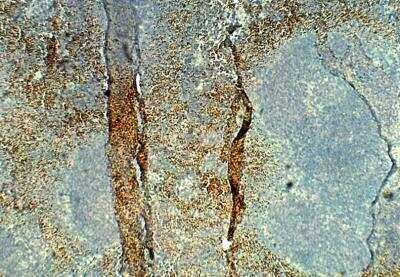 Immunohistochemistry-Paraffin: STRA6 Antibody [NBP3-12353]