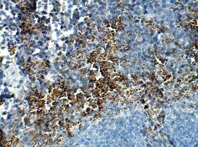 Immunohistochemistry-Paraffin: STRA6 Antibody [NBP3-12353]