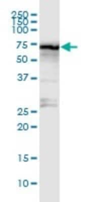 Western Blot: STRA6 Antibody [H00064220-D01P]