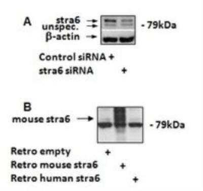 Western Blot: STRA6 Antibody [NBP1-00242]