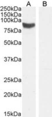 Western Blot: STRA6 Antibody [NBP1-00242]