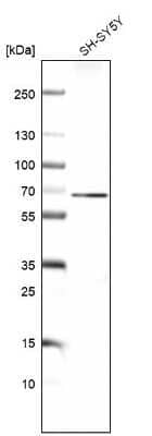 Western Blot: STRA6 Antibody [NBP1-83719]