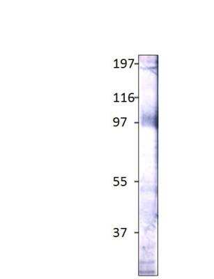 Western Blot: STRA6 Antibody [NBP3-12422]