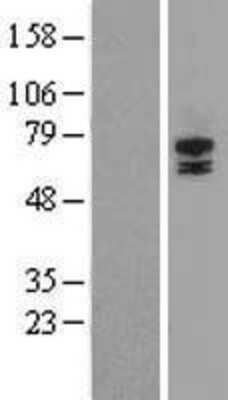 Western Blot: STRA6 Overexpression Lysate [NBP2-09664]