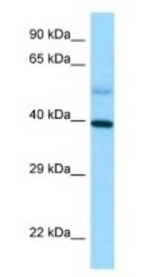 Western Blot: STRA8 Antibody [NBP1-98492]