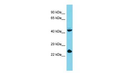 Western Blot: STRA8 Antibody [NBP2-84288]