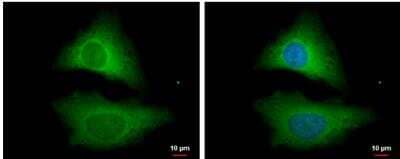 Immunocytochemistry/ Immunofluorescence: STRAP Antibody [NBP2-20521]