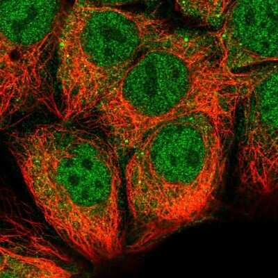 Immunocytochemistry/ Immunofluorescence: STRAP Antibody [NBP2-38757]