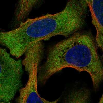 Immunocytochemistry/ Immunofluorescence: STRAP Antibody [NBP2-56502]
