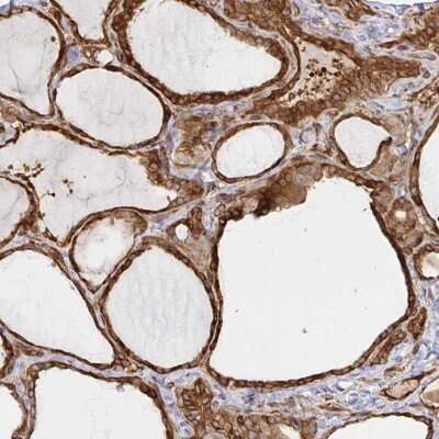 Immunohistochemistry-Paraffin: STRAP Antibody [NBP2-38757]