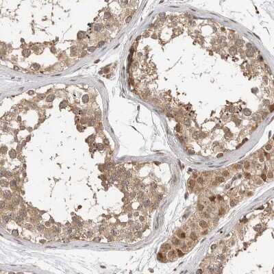 Immunohistochemistry-Paraffin: STRAP Antibody [NBP1-82796]