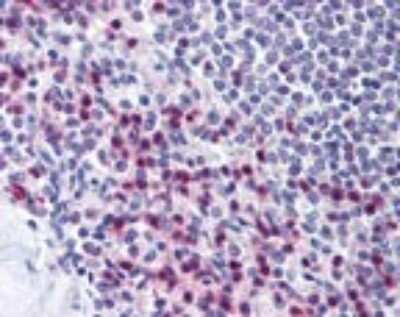 Immunohistochemistry-Paraffin: STRAP Antibody [NBP2-24740]