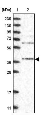 Western Blot: STRAP Antibody [NBP1-82796]