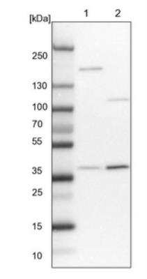 Western Blot: STRAP Antibody [NBP1-82796]