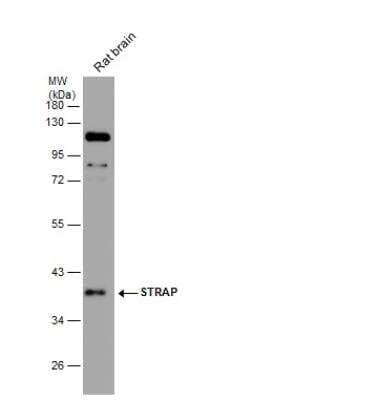 Western Blot: STRAP Antibody [NBP2-20521]