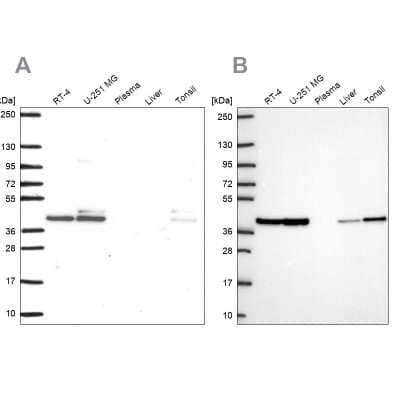 Western Blot: STRAP Antibody [NBP2-38757]