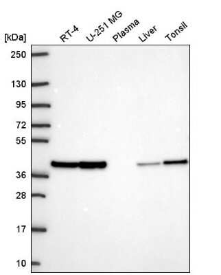 Western Blot: STRAP Antibody [NBP2-56502]